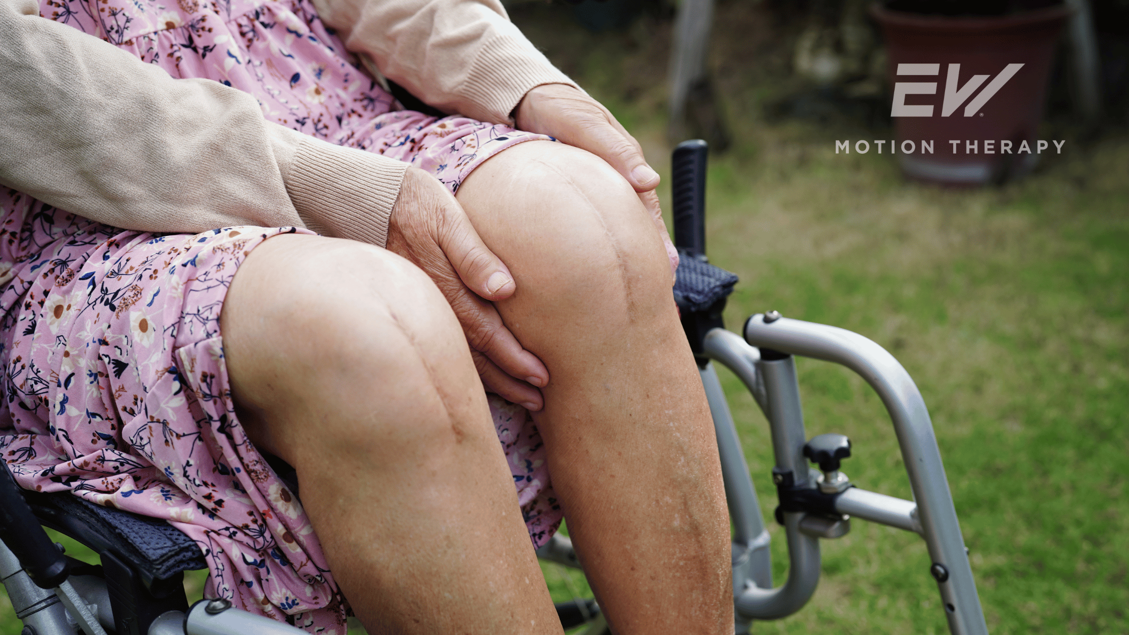 Balance Decline After Knee Replacement: Safety Considerations and the Role of Physical Therapy